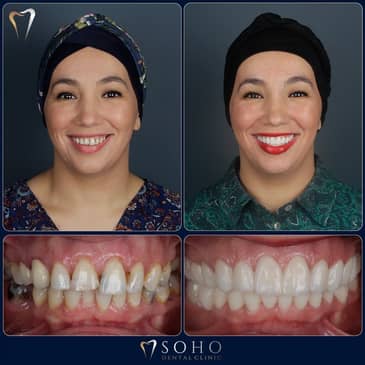 Slider image (3) Soho Dental Clinic